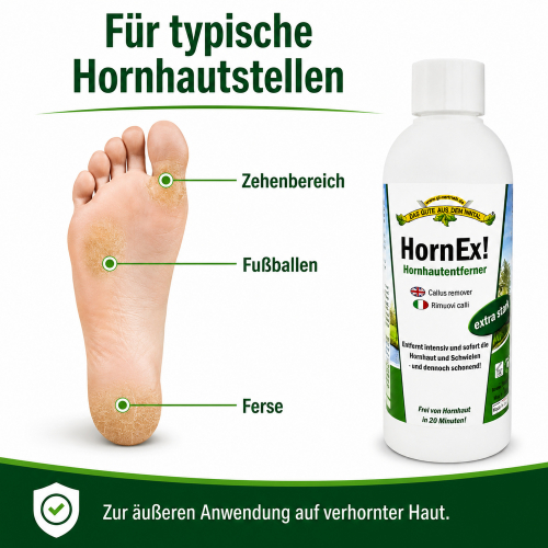 TS-139-Hornex-Hornhaut-Entferner-1
